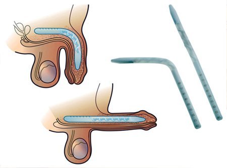 Andrology medical equipment